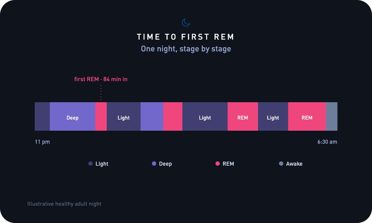 Typical Time to first REM ranges