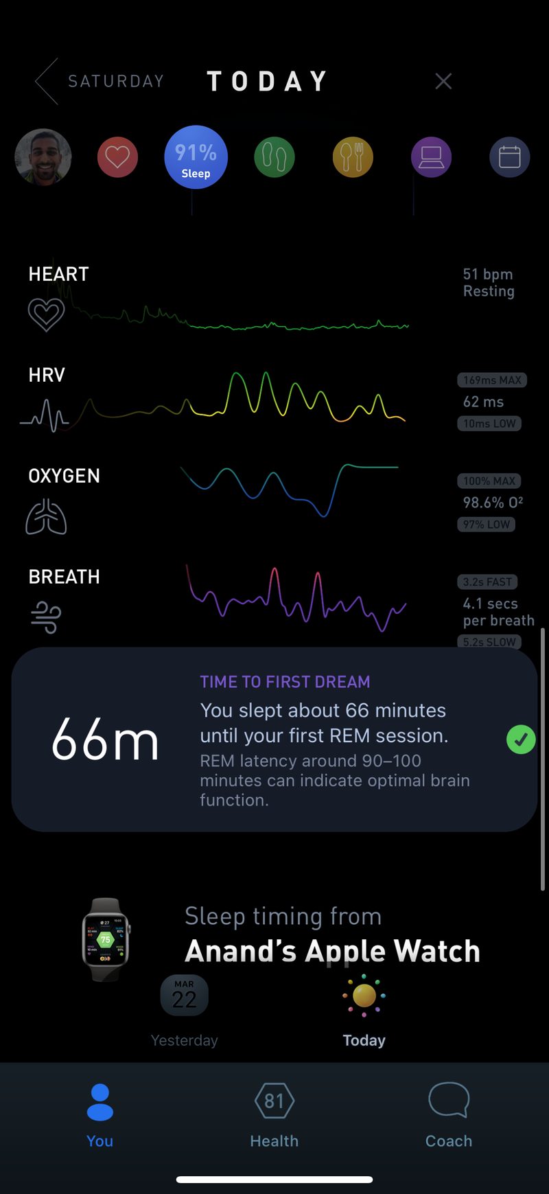 Gyroscope V8, sleep: Time to first REM
